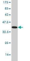 Anti-NLGN3 Antibody