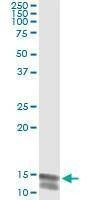 Anti-NLGN4Y Antibody