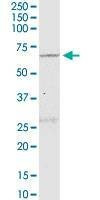Anti-NLK Antibody
