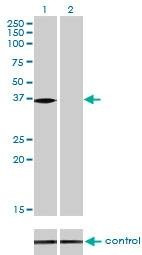 Anti-NMI Antibody