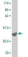 Anti-NOL4 Antibody