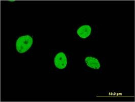 Anti-NOL4 Antibody