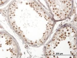 Anti-NOL4 Antibody