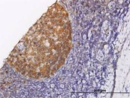 Anti-NOLC1 Antibody
