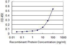 Anti-NOTCH3 Antibody