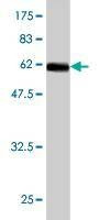 Anti-NR2E3 Antibody