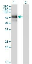 Anti-NR4A2 Antibody