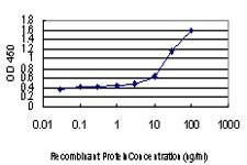 Anti-NR4A2 Antibody