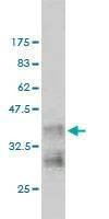 Anti-NRAS Antibody