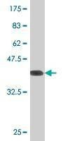 Anti-NRG2 Antibody