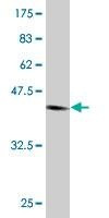 Anti-NUDT4 Antibody