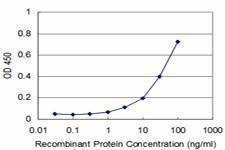 Anti-NUDT4 Antibody
