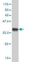 Anti-NUP133 Antibody