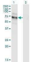 Anti-NVL Antibody