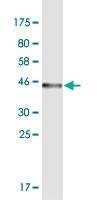 Anti-ODAM Antibody