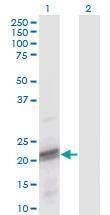 Anti-ODAM Antibody