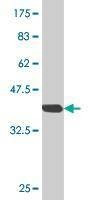 Anti-OLFM3 Antibody
