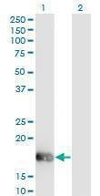 Anti-OMP Antibody
