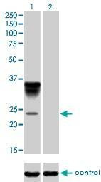 Anti-ORM1 Antibody