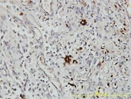Anti-ORM1 Antibody