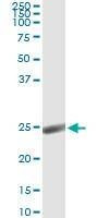 Anti-ORM1 Antibody