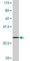 Anti-OSMR Antibody
