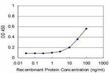 Anti-OSR1 Antibody