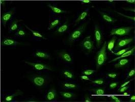 Anti-OXSR1 Antibody
