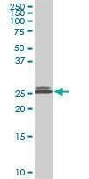 Anti-PAFAH1B3 Antibody