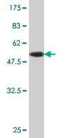 Anti-PAFAH1B3 Antibody