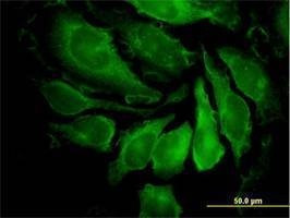 Anti-PAK1 Antibody