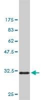 Anti-PAK1 Antibody