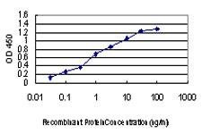 Anti-PAK1 Antibody