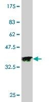 Anti-PAK3 Antibody