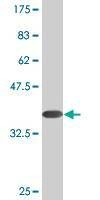 Anti-PALM Antibody