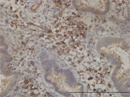 Anti-PANK2 Antibody