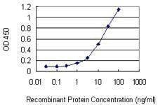 Anti-PARD3 Antibody