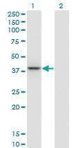 Anti-PARVG Antibody