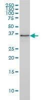 Anti-PARVG Antibody