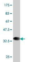 Anti-PBX1 Antibody