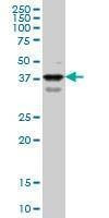 Anti-PBX1 Antibody