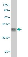 Anti-PBX2 Antibody