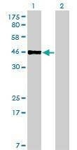 Anti-PBX2 Antibody