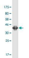 Anti-PBXIP1 Antibody