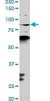 Anti-PCAF Antibody