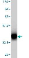 Anti-PCDH7 Antibody