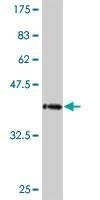 Anti-PCDHA10 Antibody
