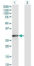 Anti-PCSK1N Antibody