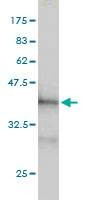 Anti-PDCD6IP Antibody