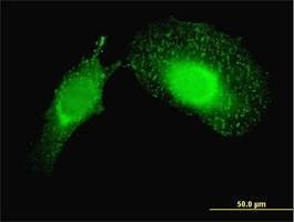 Anti-PDCD6IP Antibody